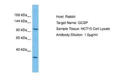 GLDC Antibody, Novus Biologicals 100 &mu;L | Buy Online | Novus Biologicals | Fisher Scientific